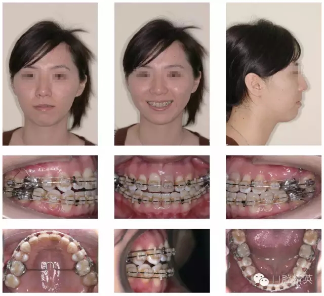 640.webp (7).jpg 640.webp (7).jpg