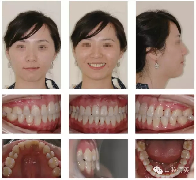 640.webp (9).jpg 640.webp (9).jpg