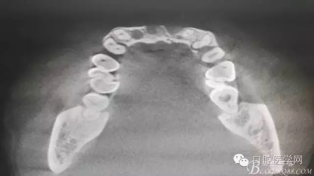 640.webp (2).jpg 640.webp (2).jpg