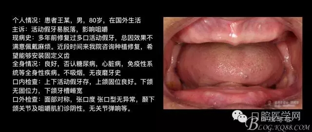 640.webp (2).jpg 640.webp (2).jpg