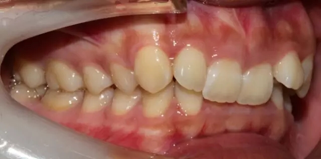 640.webp (4).jpg 640.webp (4).jpg