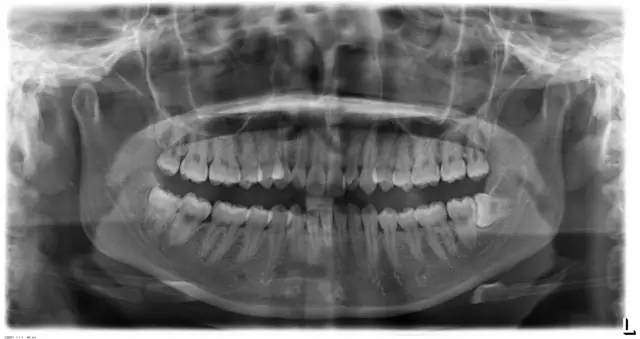 640.webp (9).jpg 640.webp (9).jpg