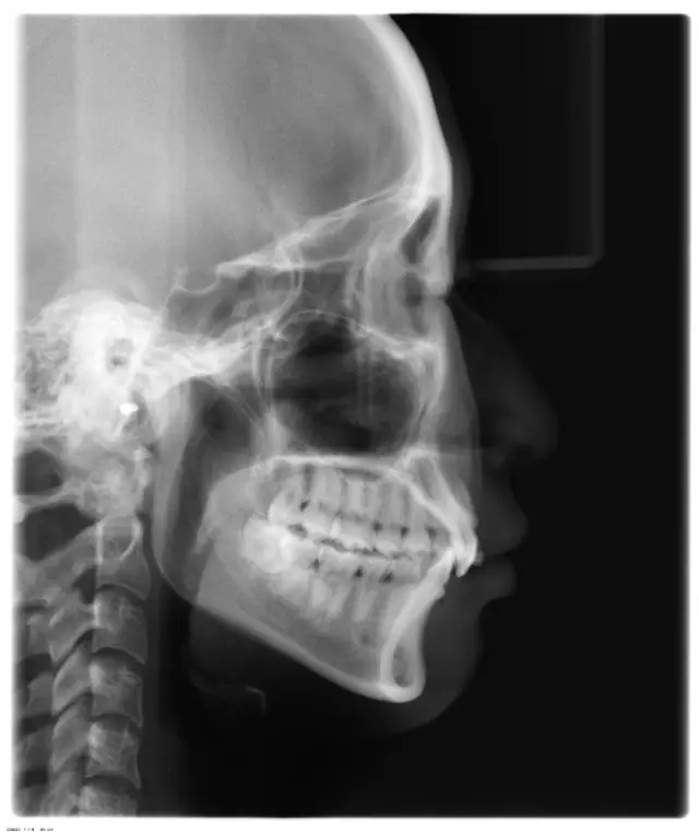 640.webp (10).jpg 640.webp (10).jpg