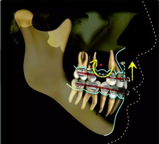 640.webp (15).jpg 640.webp (15).jpg