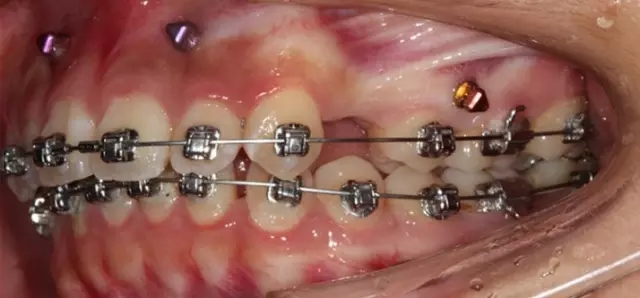 640.webp (18).jpg 640.webp (18).jpg