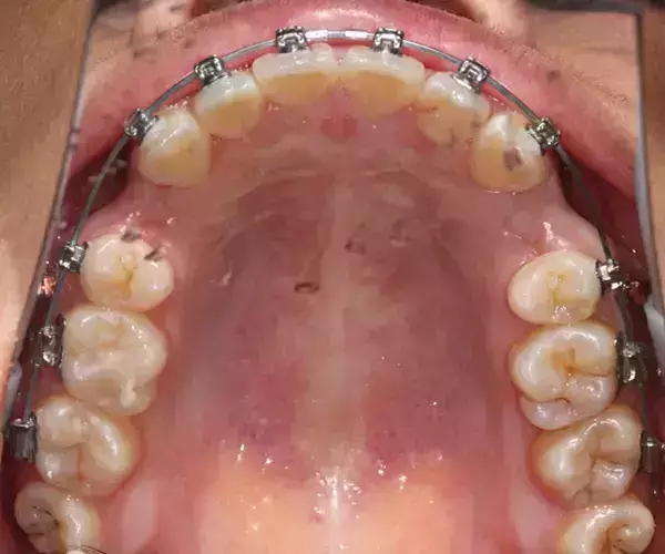 640.webp (19).jpg 640.webp (19).jpg