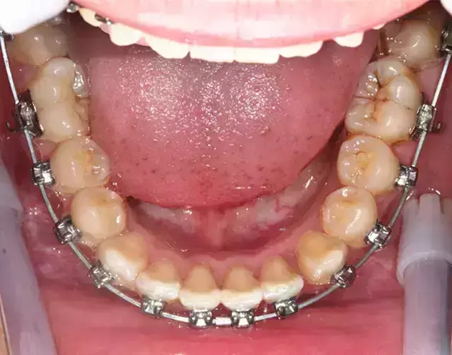 640.webp (20).jpg 640.webp (20).jpg