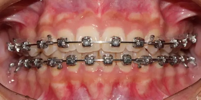 640.webp (23).jpg 640.webp (23).jpg