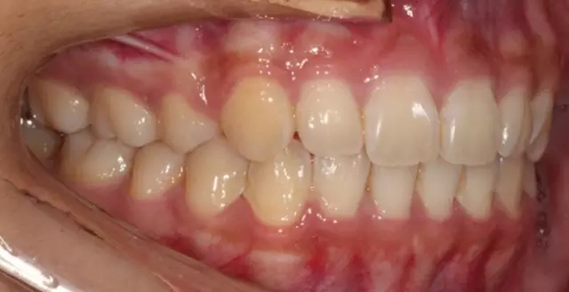 640.webp (31).jpg 640.webp (31).jpg