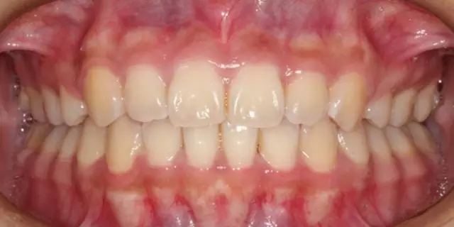 640.webp (32).jpg 640.webp (32).jpg