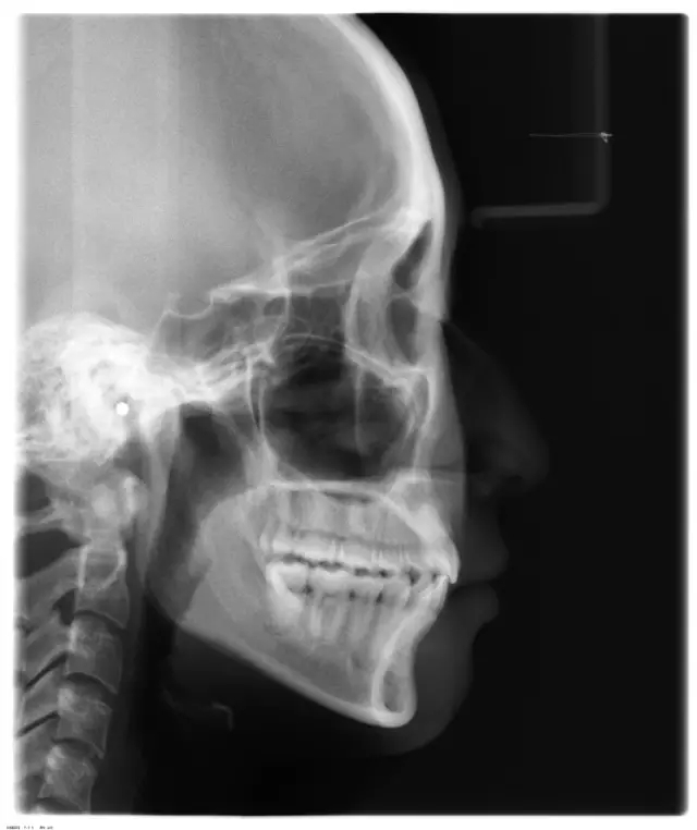 640.webp (37).jpg 640.webp (37).jpg