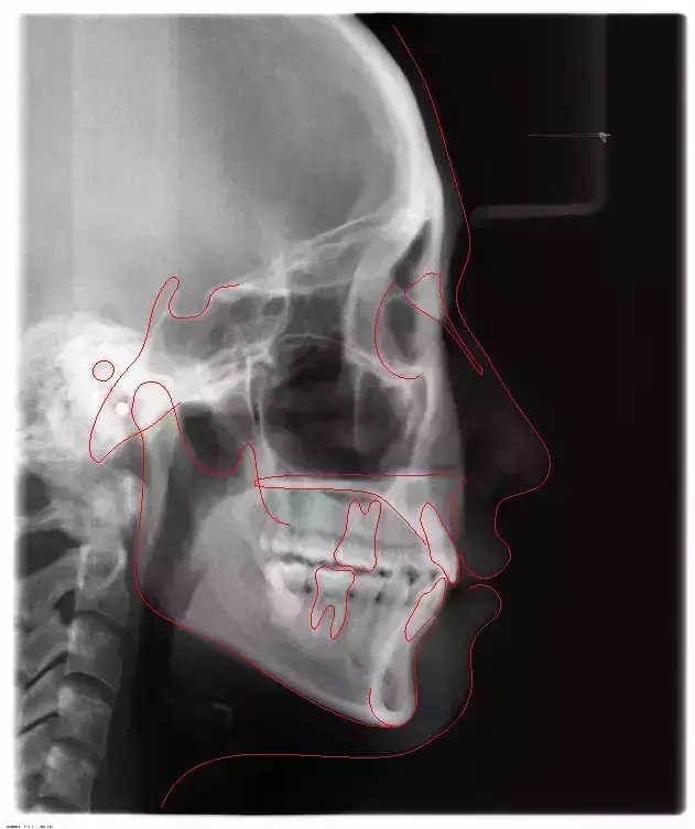 640.webp (38).jpg 640.webp (38).jpg