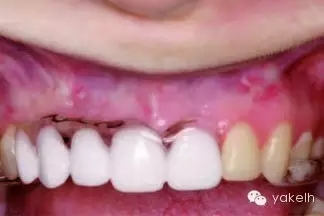 640.webp.jpg 640.webp.jpg