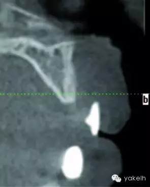 640.webp (1).jpg 640.webp (1).jpg