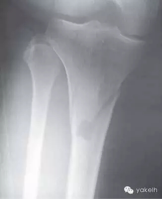 640.webp (13).jpg 640.webp (13).jpg