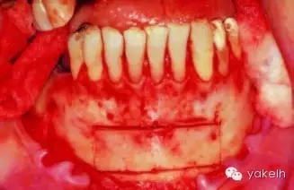 640.webp (17).jpg 640.webp (17).jpg