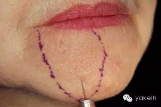 640.webp (26).jpg 640.webp (26).jpg