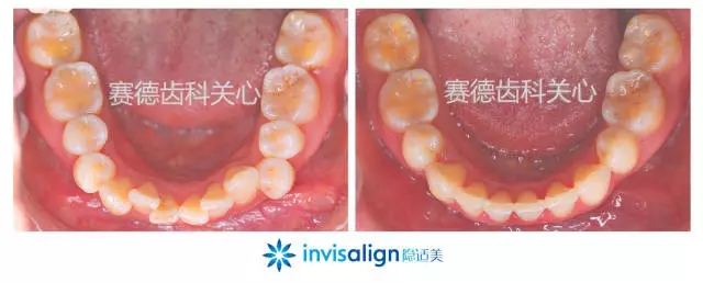 640.webp.jpg 640.webp.jpg