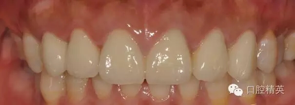 640.webp (17).jpg 640.webp (17).jpg