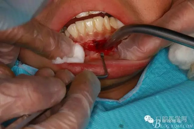 640.webp (1).jpg 640.webp (1).jpg