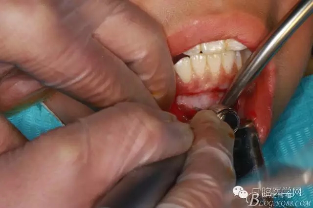 640.webp (3).jpg 640.webp (3).jpg