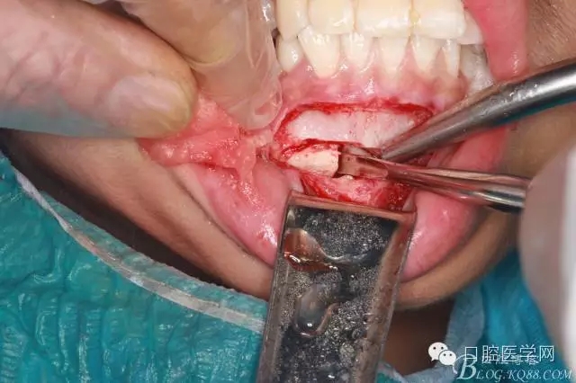 640.webp (5).jpg 640.webp (5).jpg