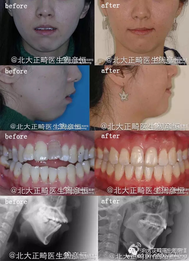 640.webp (2).jpg 640.webp (2).jpg