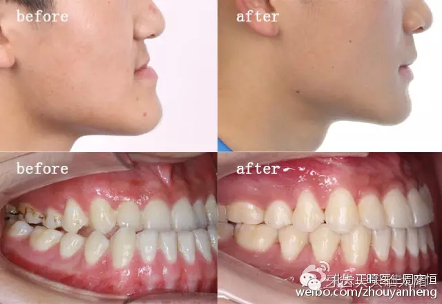 640.webp (4).jpg 640.webp (4).jpg