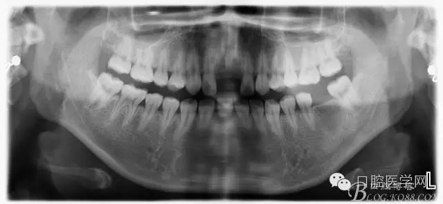 640.webp.jpg 640.webp.jpg