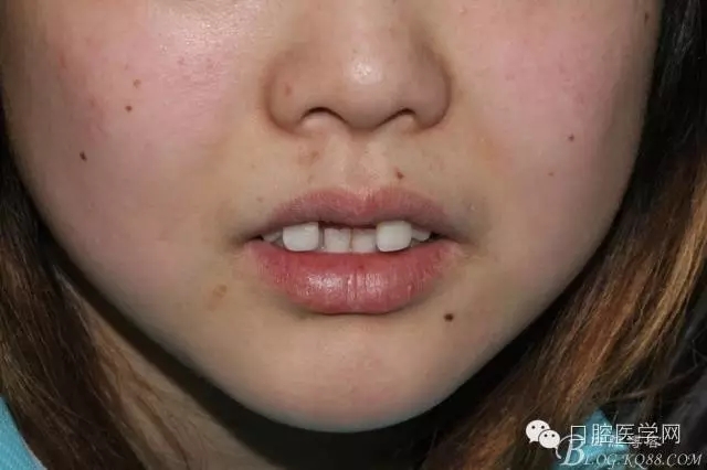 640.webp (1).jpg 640.webp (1).jpg