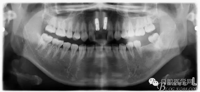 640.webp (3).jpg 640.webp (3).jpg