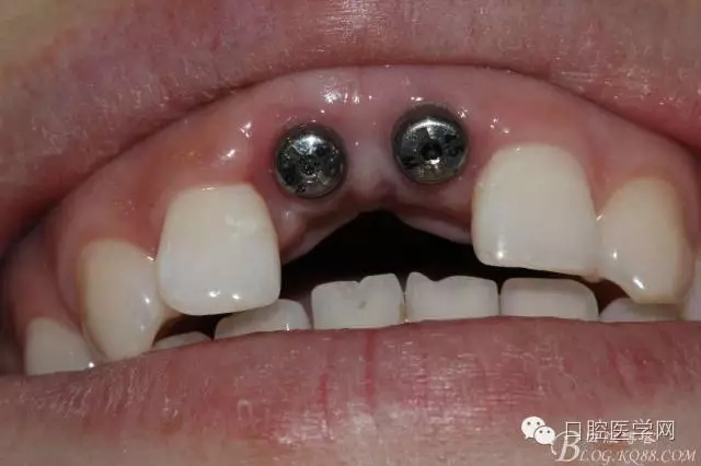 640.webp (4).jpg 640.webp (4).jpg