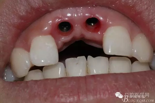 640.webp (5).jpg 640.webp (5).jpg