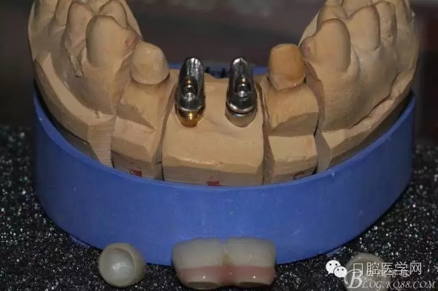 640.webp (13).jpg 640.webp (13).jpg