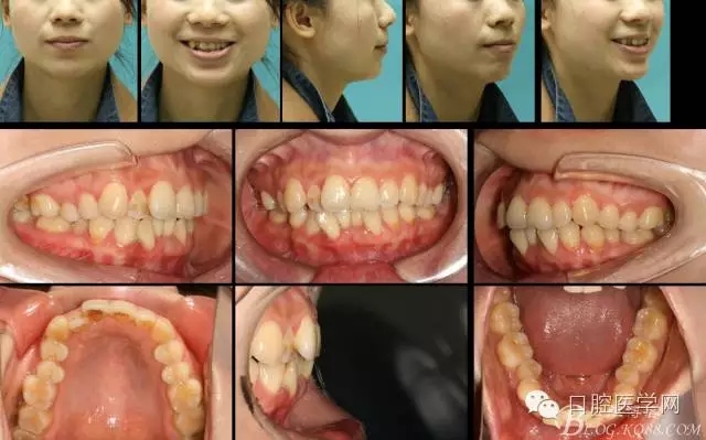 640.webp.jpg 640.webp.jpg