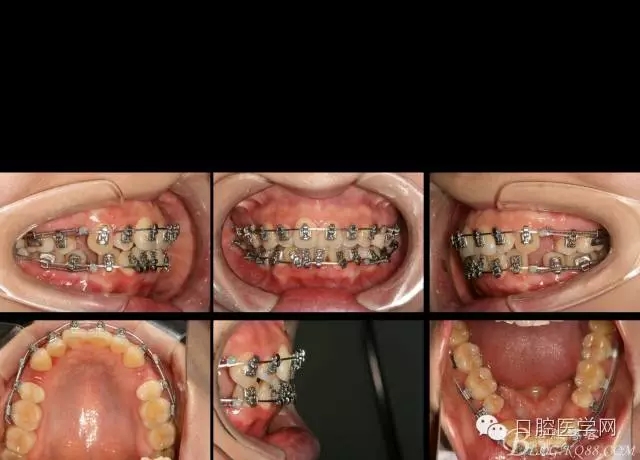 640.webp (3).jpg 640.webp (3).jpg