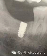 640.webp.jpg 640.webp.jpg