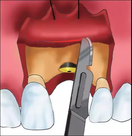 640.webp (9).jpg 640.webp (9).jpg