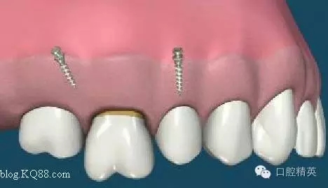 640.webp (1).jpg 640.webp (1).jpg