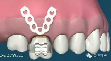 640.webp (4).jpg 640.webp (4).jpg