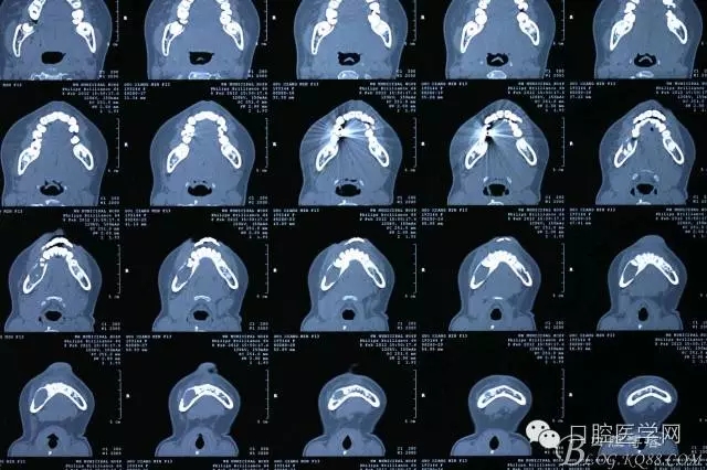 640.webp (1).jpg 640.webp (1).jpg