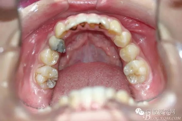 640.webp (2).jpg 640.webp (2).jpg