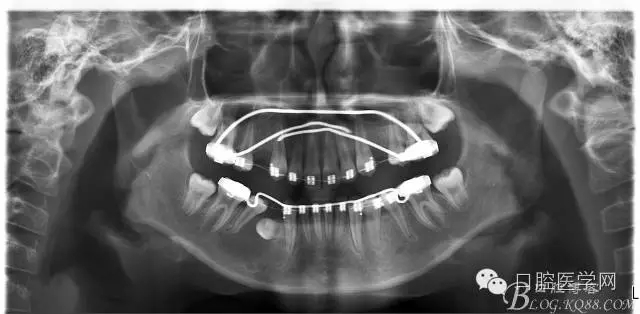 640.webp (5).jpg 640.webp (5).jpg