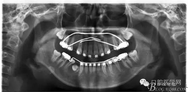 640.webp (6).jpg 640.webp (6).jpg