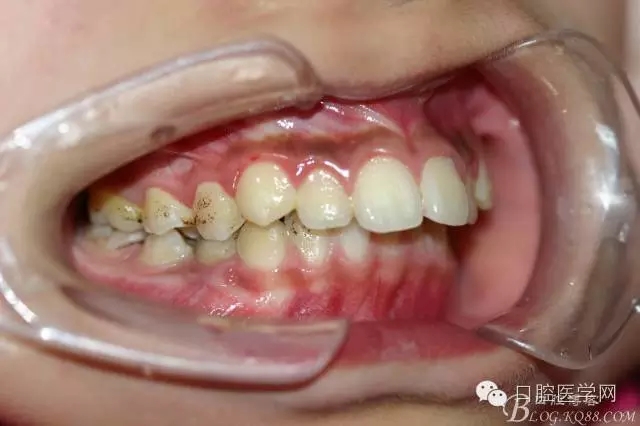 640.webp (10).jpg 640.webp (10).jpg