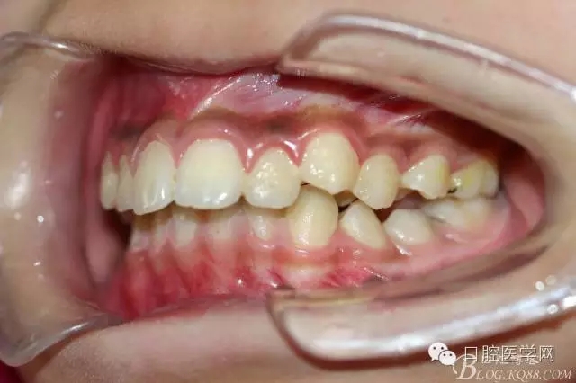 640.webp (11).jpg 640.webp (11).jpg