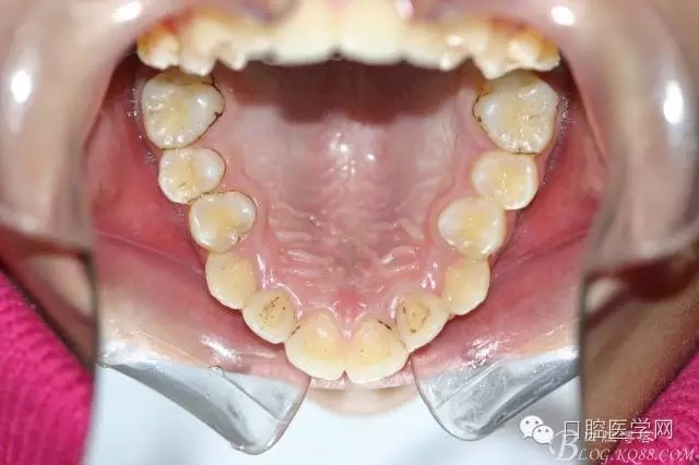 640.webp (12).jpg 640.webp (12).jpg