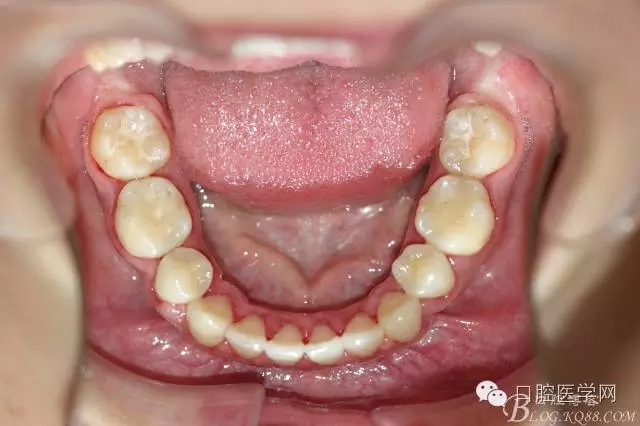 640.webp (19).jpg 640.webp (19).jpg