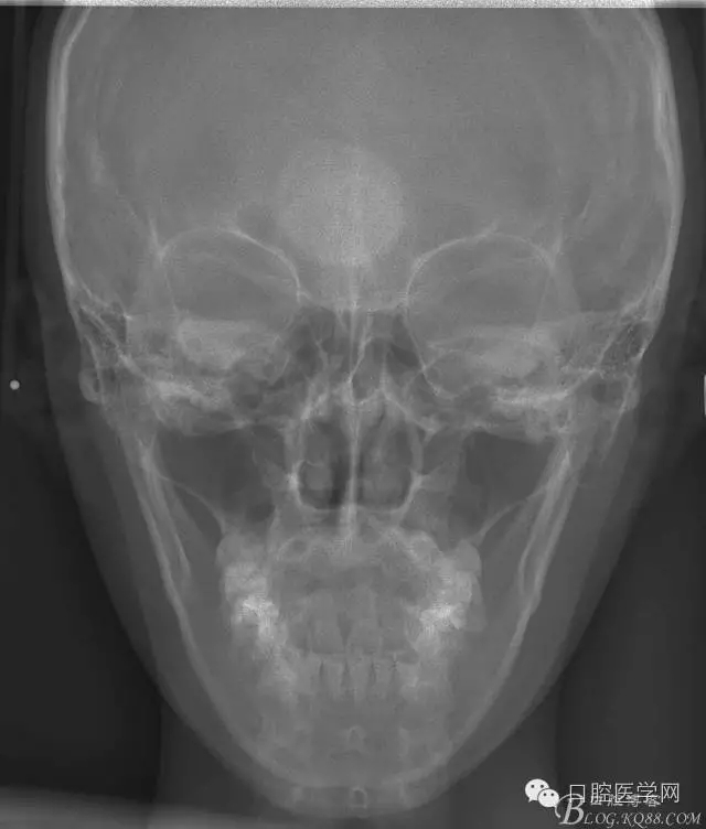 640.webp (28).jpg 640.webp (28).jpg