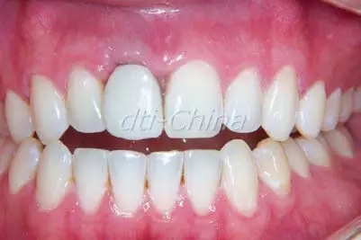 640.webp (1).jpg 640.webp (1).jpg